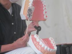 ムシバイキンがいるよ